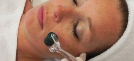 Microneedling dermaroller