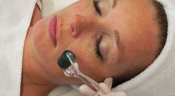 Microneedling dermaroller